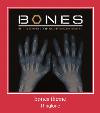 Bones Theme zil sesi
